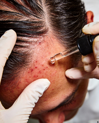 Image gallery marquee