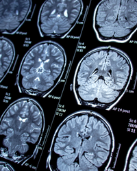 Image gallery marquee