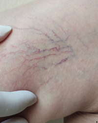 Image gallery marquee