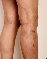 Image gallery marquee