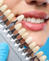 Image gallery marquee