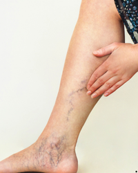 Image gallery marquee