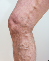 Image gallery marquee