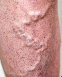 Image gallery marquee