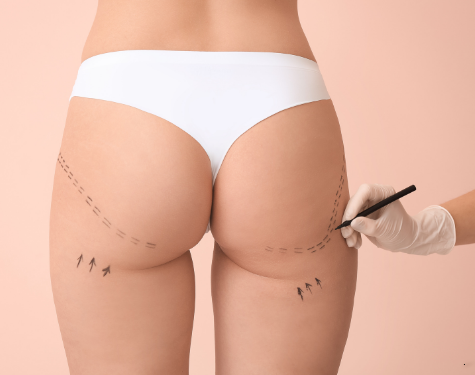 Image gallery marquee